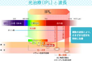 光フォトエステ