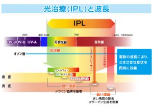 光フォトエステ